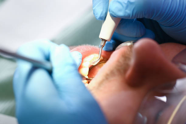 Best Pediatric Emergency Dentist in Lockwood, MO