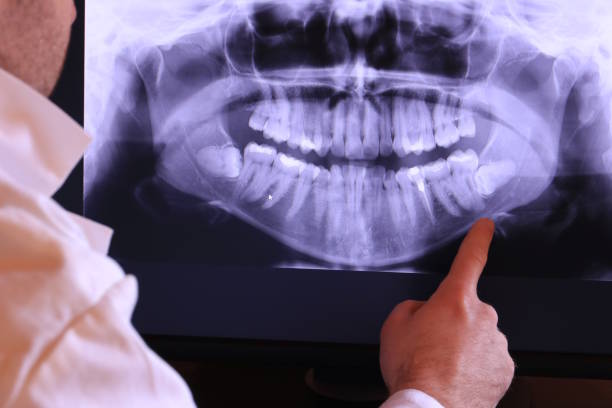 Best Emergency Gum Treatment in Lockwood, MO